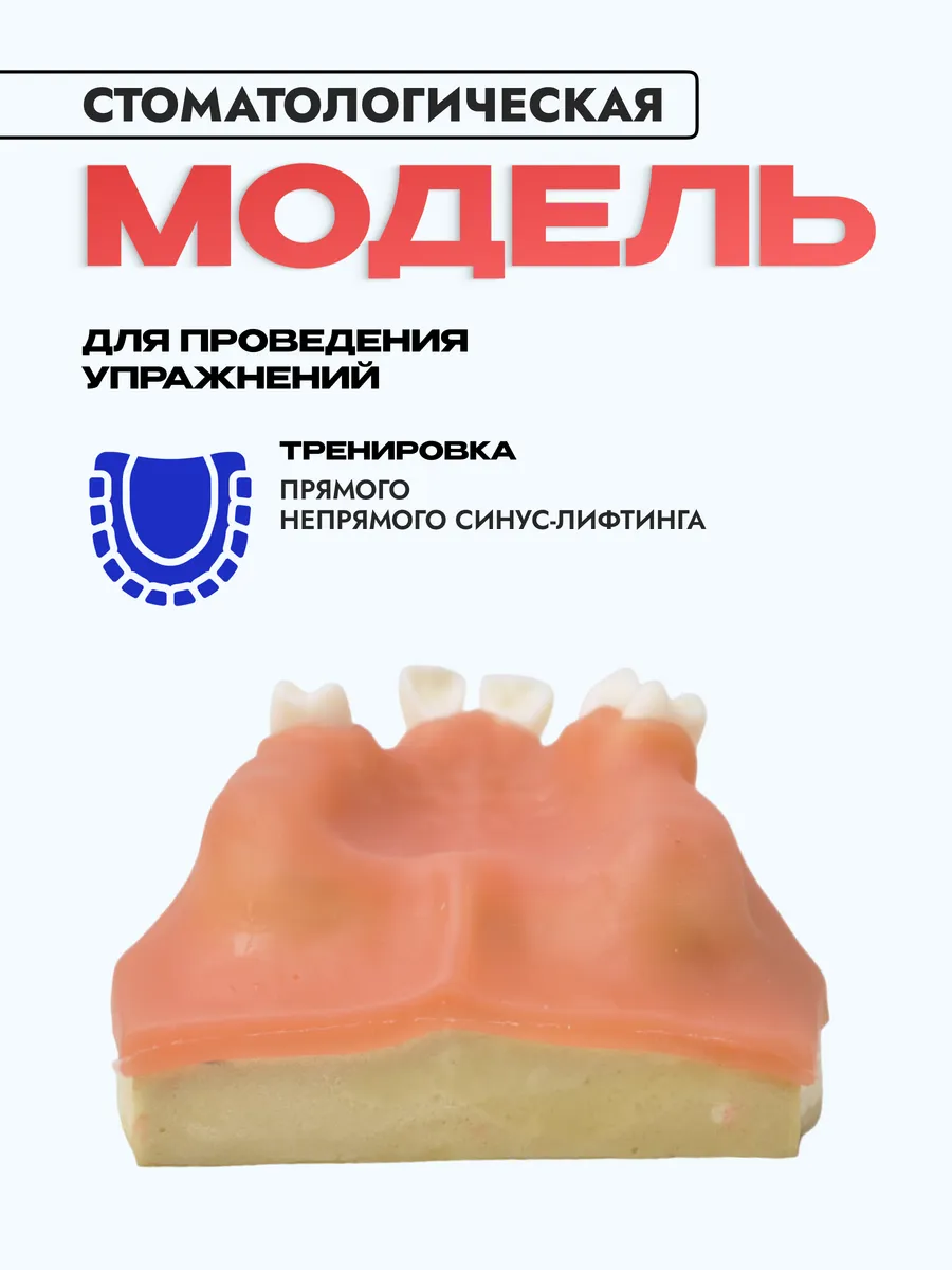 Модель верхней челюсти для имплантологического тренинга