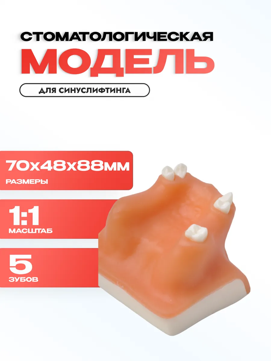 Модель верхней челюсти для имплантологического тренинга