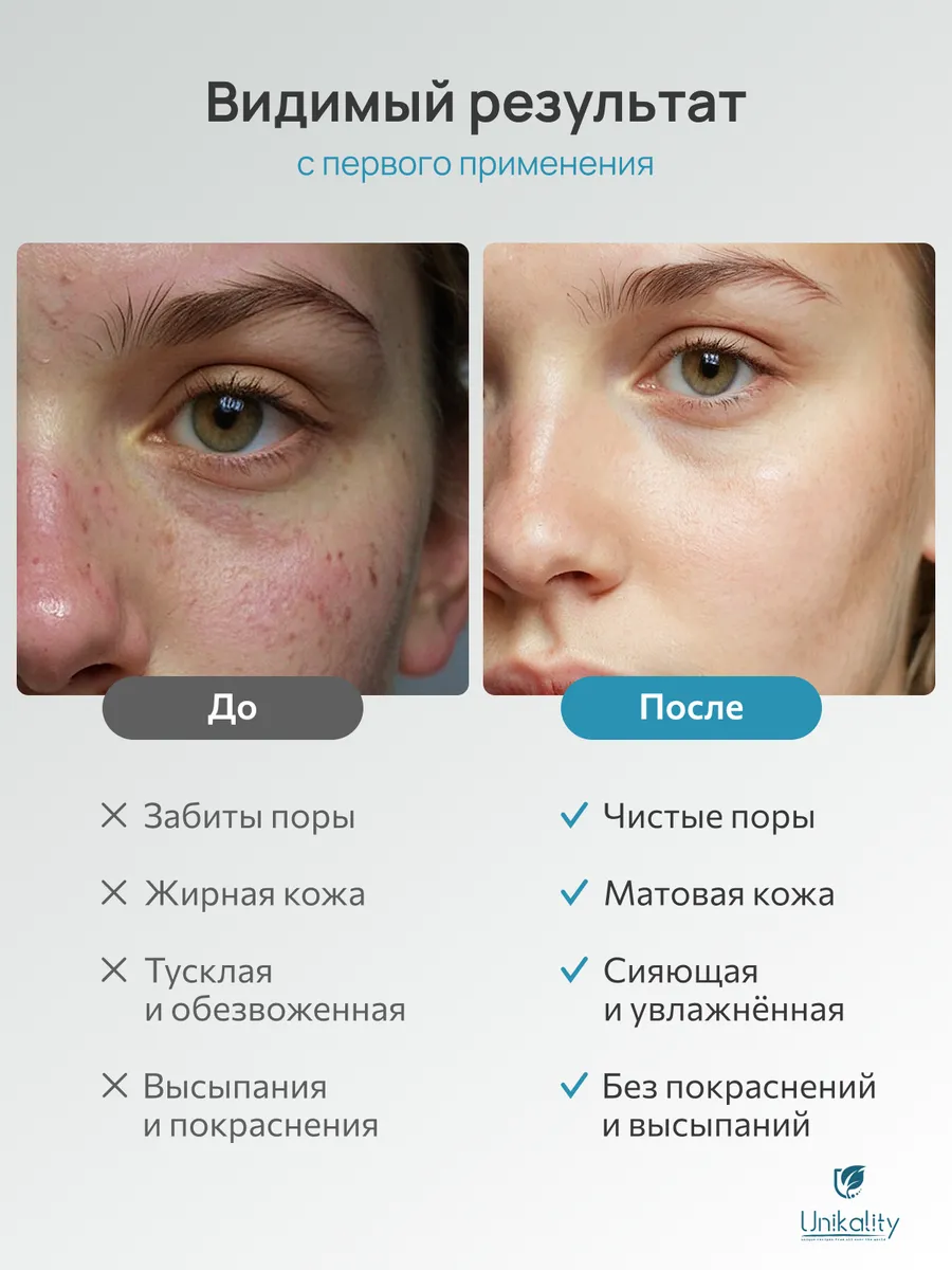 Пенка для умывания лица увлажняющая